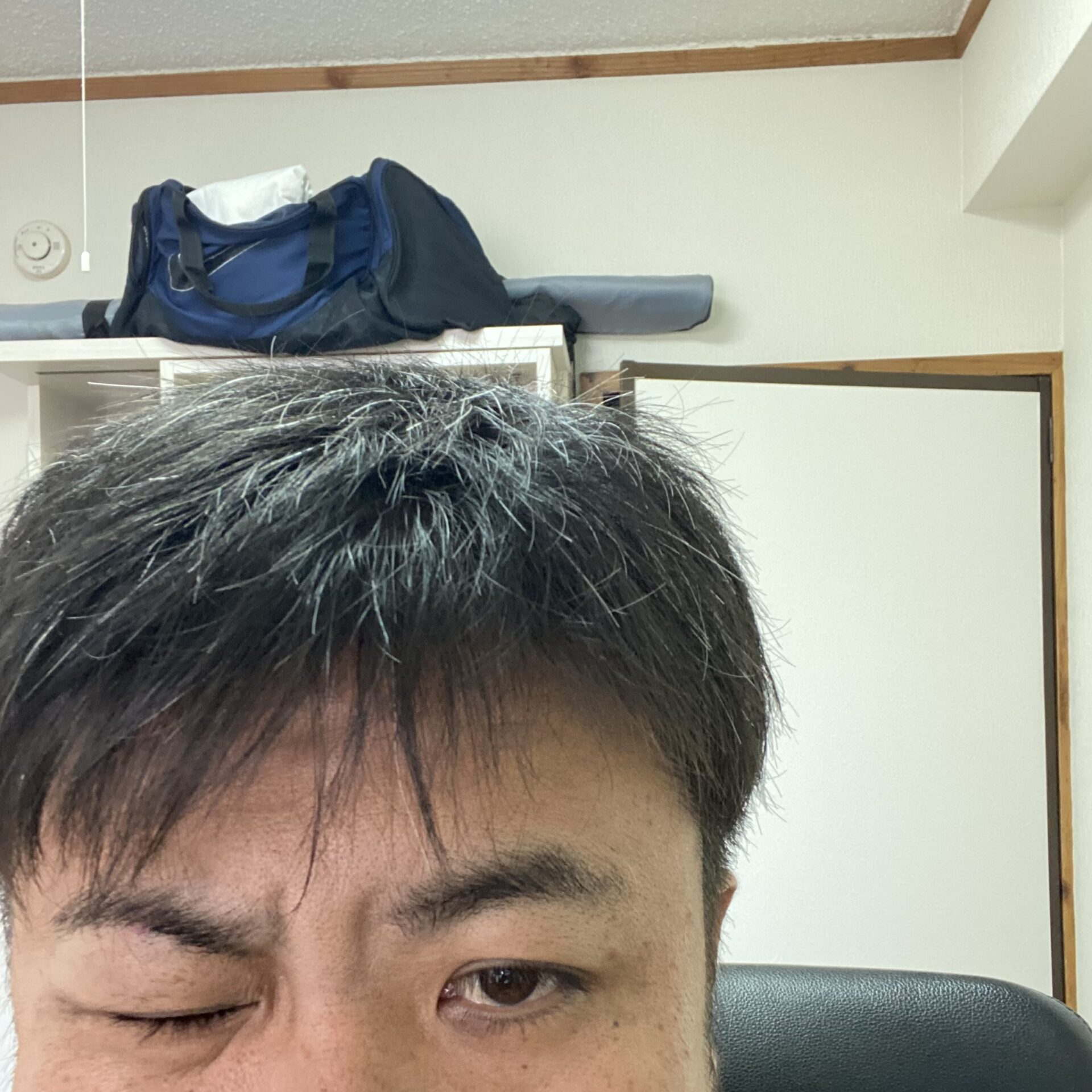 片側性顔面痙攣の手術日記その③聴覚・味覚検査🦻